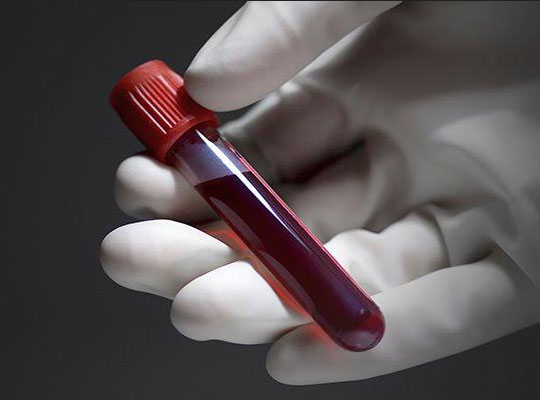 Blood Testing